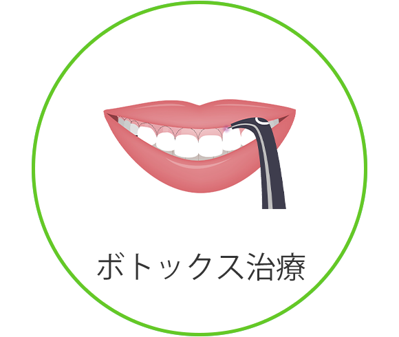 画像：ボトックス治療